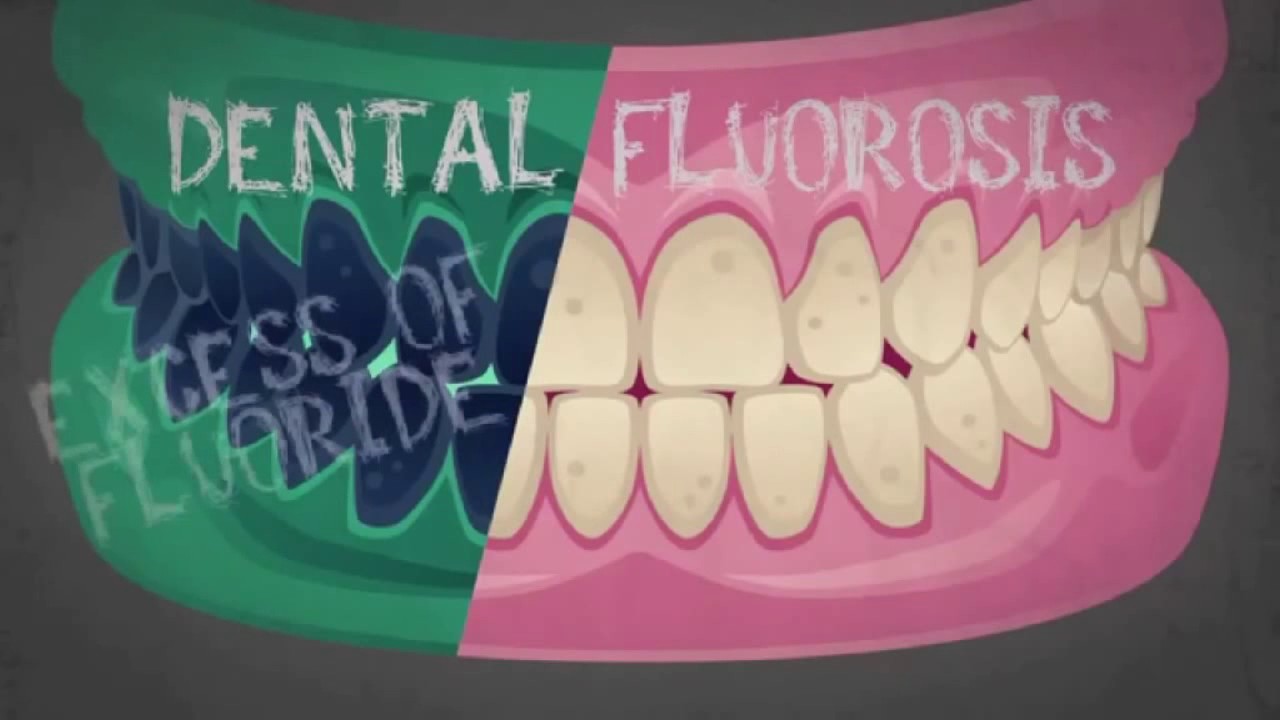 Anonymous Presents - The Truth About Fluoride